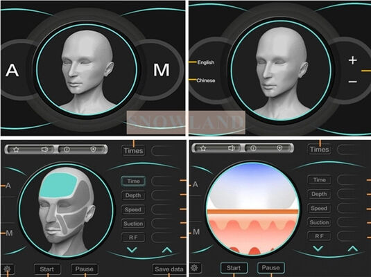Dioda laserowa 808nm do depilacji laserowej z czujnikiem kontaktu ze skórą zapewniającym szybkie usuwanie owłosienia