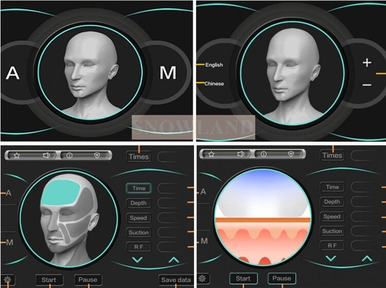 Dioda laserowa 808nm do depilacji laserowej z czujnikiem kontaktu ze skórą zapewniającym szybkie usuwanie owłosienia